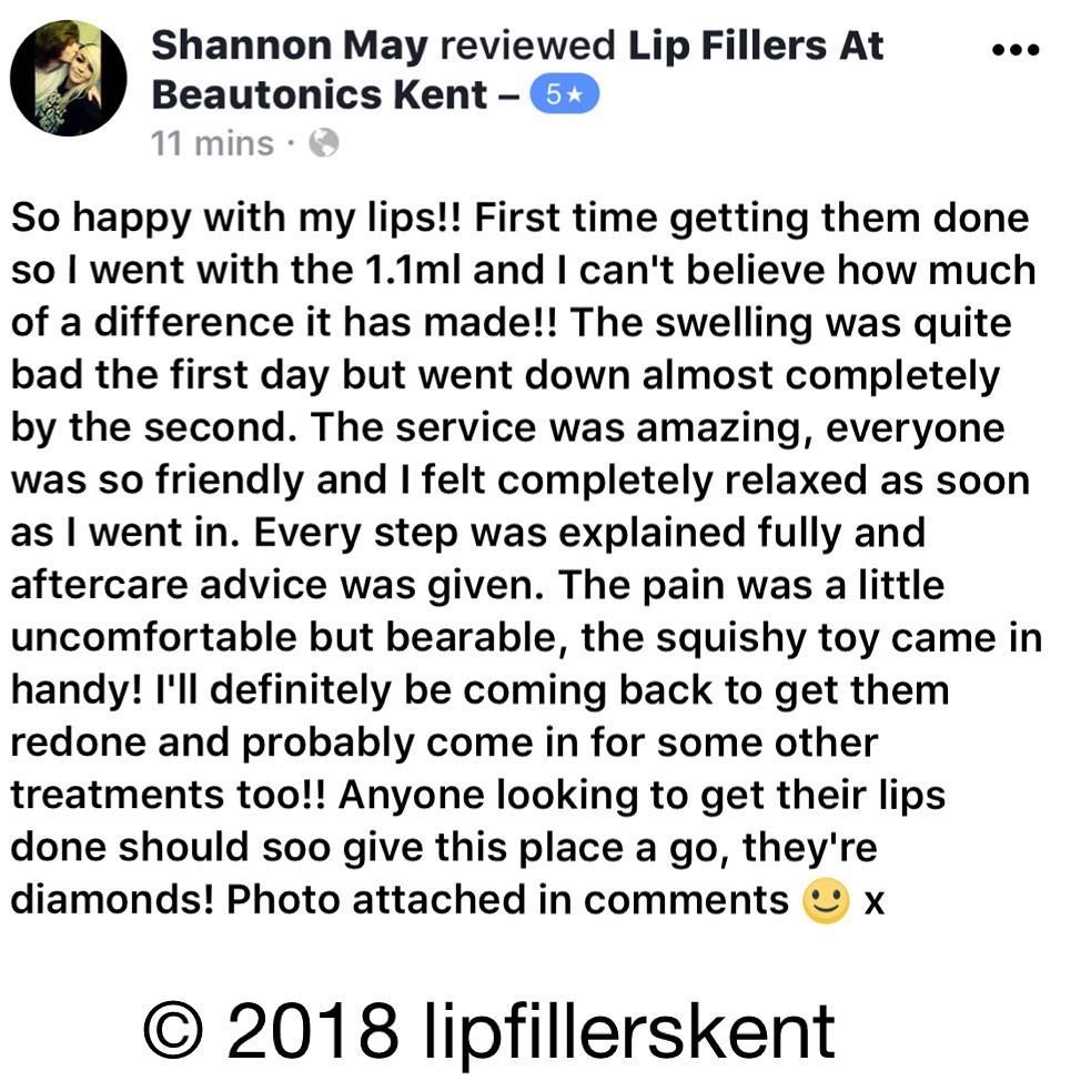 lipfillerskentreview4